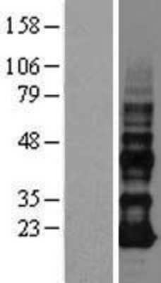 Western Blot: VOPP1 Overexpression Lysate [NBL1-10101]