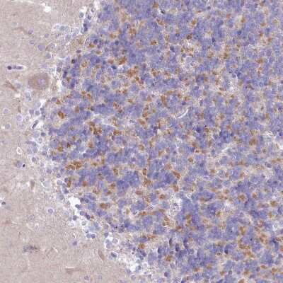 Immunohistochemistry-Paraffin: VP26B Antibody [NBP1-92575]