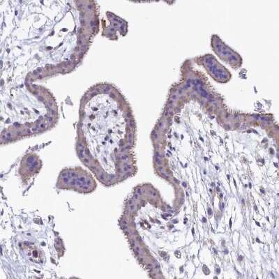 Immunohistochemistry-Paraffin: VP26B Antibody [NBP1-92575]