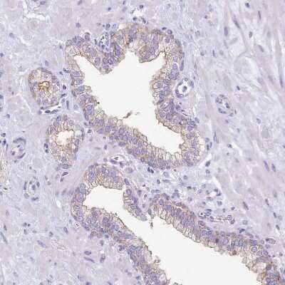 Immunohistochemistry-Paraffin: VP26B Antibody [NBP1-92575]
