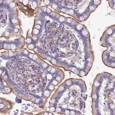 Immunohistochemistry-Paraffin: VP26B Antibody [NBP1-92575]