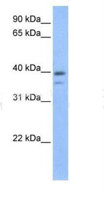 Western Blot: VP26B Antibody [NBP1-56502]