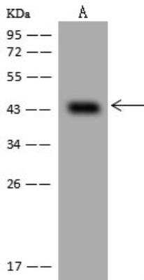 Western Blot: VP26B Antibody [NBP3-12624]