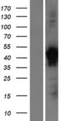 Western Blot: VP26B Overexpression Lysate [NBP2-05846]