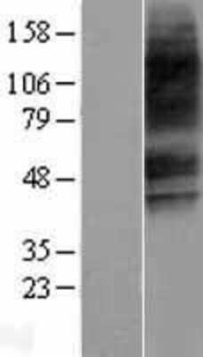 Western Blot: VIPR2/VPAC2 Overexpression Lysate [NBP2-04248]