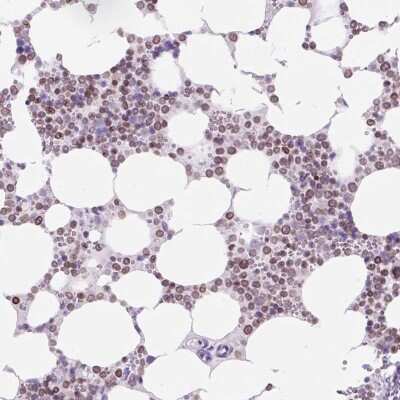 Immunohistochemistry: VPREB1 Antibody [NBP2-49200]