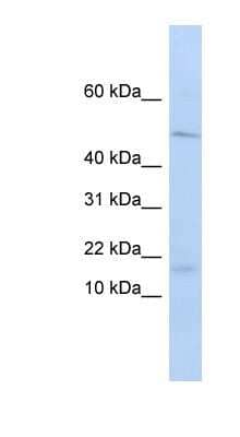 Western Blot: VPREB1 Antibody [NBP1-70741]