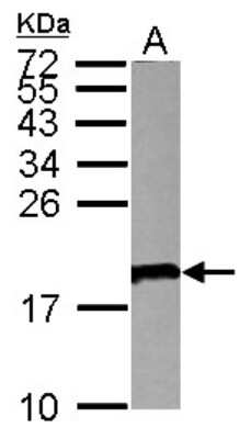 Western Blot: VPREB1 Antibody [NBP2-20868]