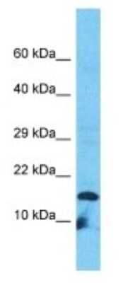 Western Blot: VPREB3 Antibody [NBP3-09504]