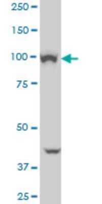 Western Blot: VPS11 Antibody (1H1) [H00055823-M01]