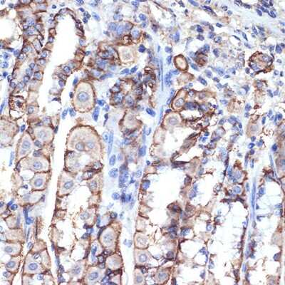 Immunohistochemistry-Paraffin: VPS11 Antibody (8L3D8) [NBP3-15923]