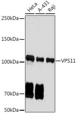 Western Blot: VPS11 Antibody (8L3D8) [NBP3-15923]