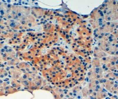 Immunohistochemistry-Paraffin: VPS11 Antibody [NB100-2412]