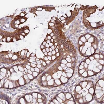 Immunohistochemistry-Paraffin: VPS11 Antibody [NBP2-47583]
