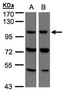 Western Blot: VPS11 Antibody [NBP1-31054]