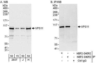 Western Blot: VPS11 Antibody [NBP2-04092]