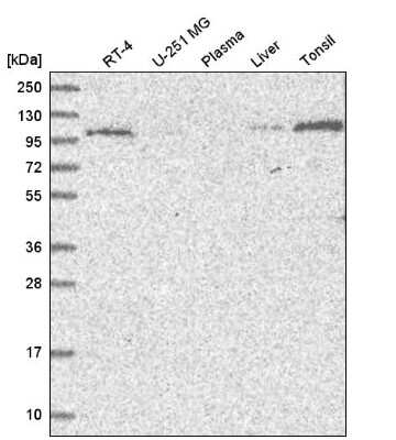 Western Blot: VPS11 Antibody [NBP2-47583]