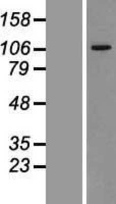 Western Blot: VPS11 Overexpression Lysate [NBL1-17736]