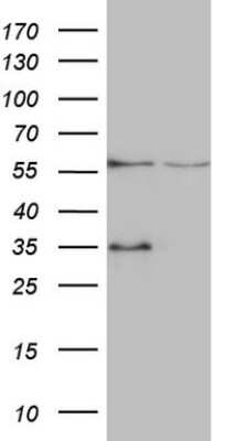 Western Blot: VPS13B Antibody (OTI6F6) [NBP2-46350]