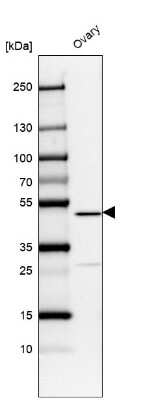 Western Blot: VPS13B Antibody [NBP2-55104]