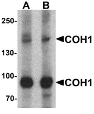 Western Blot: VPS13B AntibodyBSA Free [NBP2-82052]