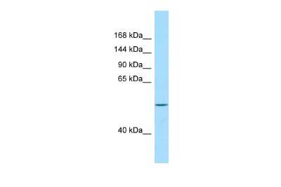 Western Blot: VPS13B Antibody [NBP2-86055]