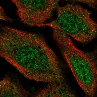 Immunocytochemistry/ Immunofluorescence: VPS13D Antibody [NBP2-58336]