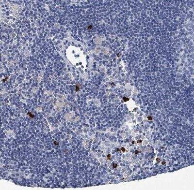 Immunohistochemistry-Paraffin: VPS13D Antibody [NBP2-14742]