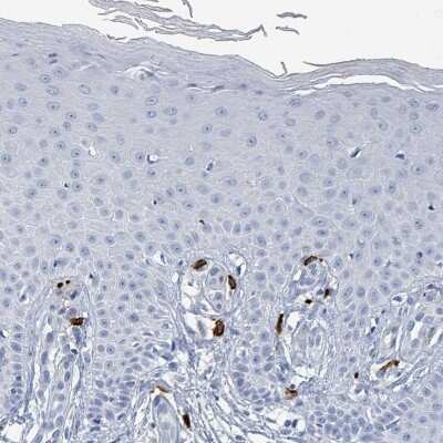 Immunohistochemistry-Paraffin: VPS13D Antibody [NBP2-14742]