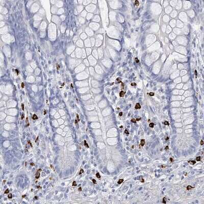 Immunohistochemistry-Paraffin: VPS13D Antibody [NBP2-14742]