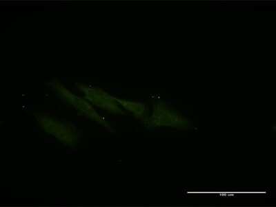 Immunocytochemistry/ Immunofluorescence: VPS16 Antibody (2F10) [H00064601-M05]
