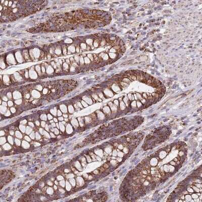 Immunohistochemistry: VPS16 Antibody [NBP2-48912]