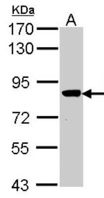 Western Blot: VPS16 Antibody [NBP1-31455]