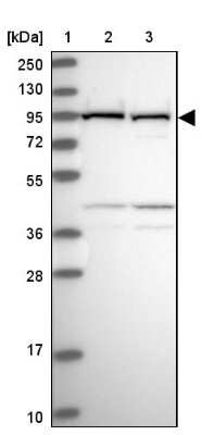 Western Blot: VPS16 Antibody [NBP2-48785]