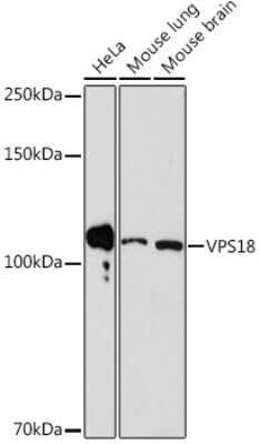 Western Blot: VPS18 Antibody (1W8T9) [NBP3-15542]