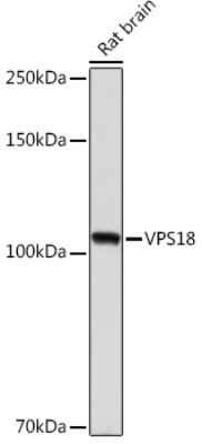 Western Blot: VPS18 Antibody (1W8T9) [NBP3-15542]