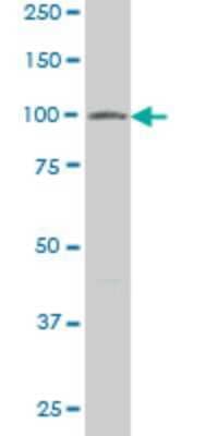 Western Blot: VPS18 Antibody (2G10) [H00057617-M02]