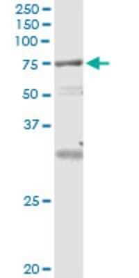 Immunoprecipitation: VPS18 Antibody (4E9) [H00057617-M04]