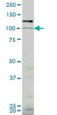 Western Blot: VPS18 Antibody (4E9) [H00057617-M04]