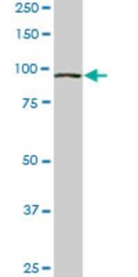 Western Blot: VPS18 Antibody (4F8) [H00057617-M01]