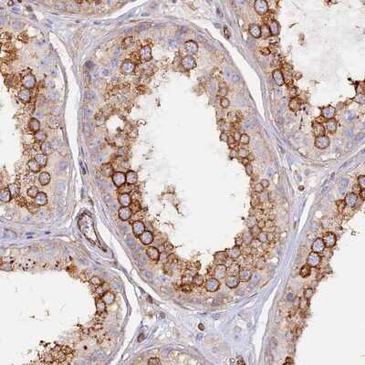 Immunohistochemistry-Paraffin: VPS18 Antibody [NBP1-82906]