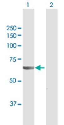 Western Blot: VPS18 Antibody [H00057617-D01P]