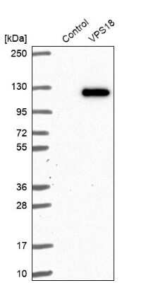 Western Blot: VPS18 Antibody [NBP1-82906]