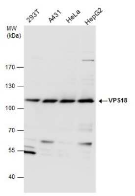 Western Blot: VPS18 Antibody [NBP3-12906]