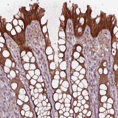 Immunohistochemistry-Paraffin: VPS24 Antibody [NBP2-68954]
