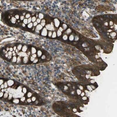 Immunohistochemistry-Paraffin: VPS24 Antibody [NBP1-89391]