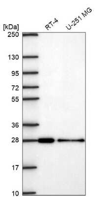 Western Blot: VPS24 Antibody [NBP2-68954]