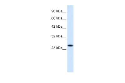 Western Blot: VPS24 Antibody [NBP2-88580]