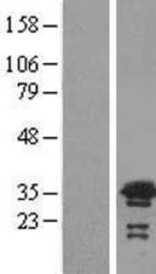 Western Blot: VPS24 Overexpression Lysate [NBL1-17738]