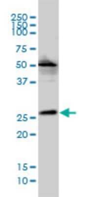 Western Blot: VPS25 Antibody (2E5-2B9) [H00084313-M01]